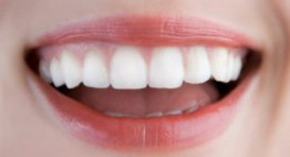 Bọc mão răng sứ – Giải pháp mang đến sự hoàn mỹ cho nụ cười