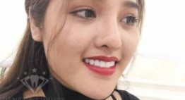 “Ngã ngửa” với sự thật bọc răng sứ có tốt không? – Tìm hiểu ngay