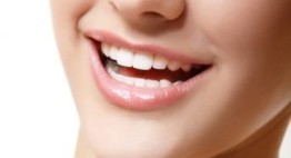 Răng sứ Cercon giá bao nhiêu? Bảng giá chi tiết cho các dòng răng sứ