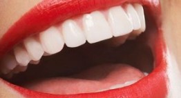 Thẻ bảo hành răng sứ Cercon: Chính sách và chế độ tốt nhất